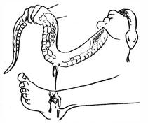 Versant le sang d’un serpent sur une morsure de serpent sur le pied d’une personne.