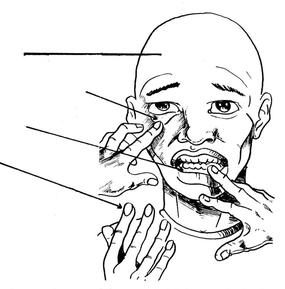 Le visage et les mains d’un homme avec des flèches pointant vers le front, l’intérieur des paupières, les gencives et les ongles